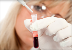 Как сдают анализ крови на краснуху thumbnail